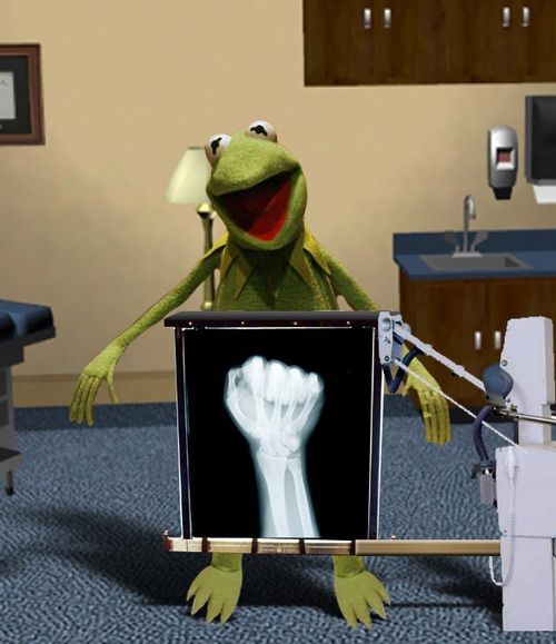 kermit muppet fist x-ray