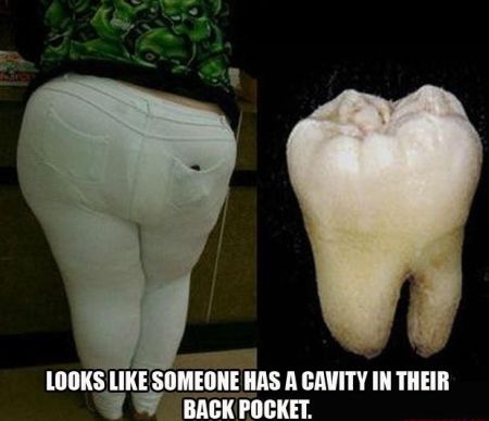 looks like someone has a cavity in their back pocket