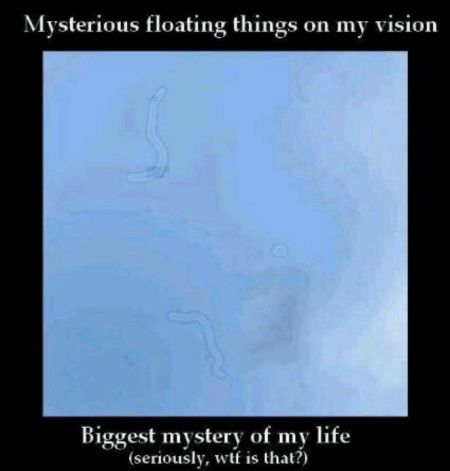 Mysterious floating things on my vision at PMSLweb.com