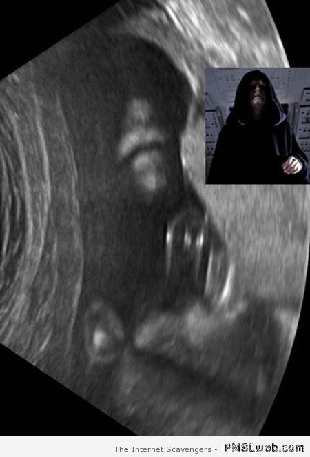 Emperor Palapine ultrasound at PMSLweb.com