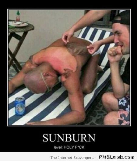 Sunburn fail at PMSLweb.com