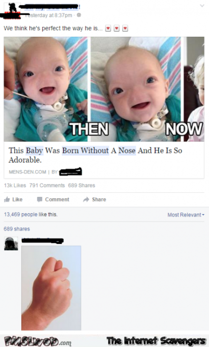Baby born without a nose funny comment