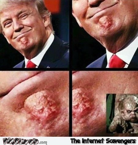 Funny Trump chin – Funny Friday pics @PMSLweb.com