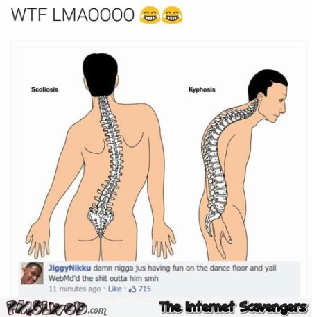 Funny scoliosis comment