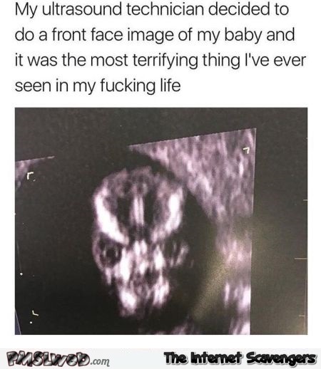 Funny front face ultrasound of baby meme - LMAO memes and pics @PMSLweb.com