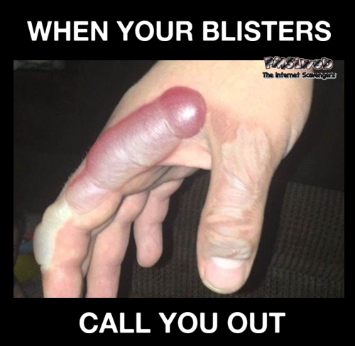 When your blisters call you out funny adult meme @PMSLweb.com